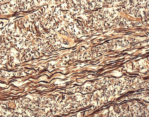 Microscopy image of axons in brain section. Photo by James Mandell. 